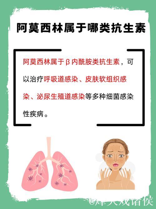 阿莫林或将调整阵型为4-3-3